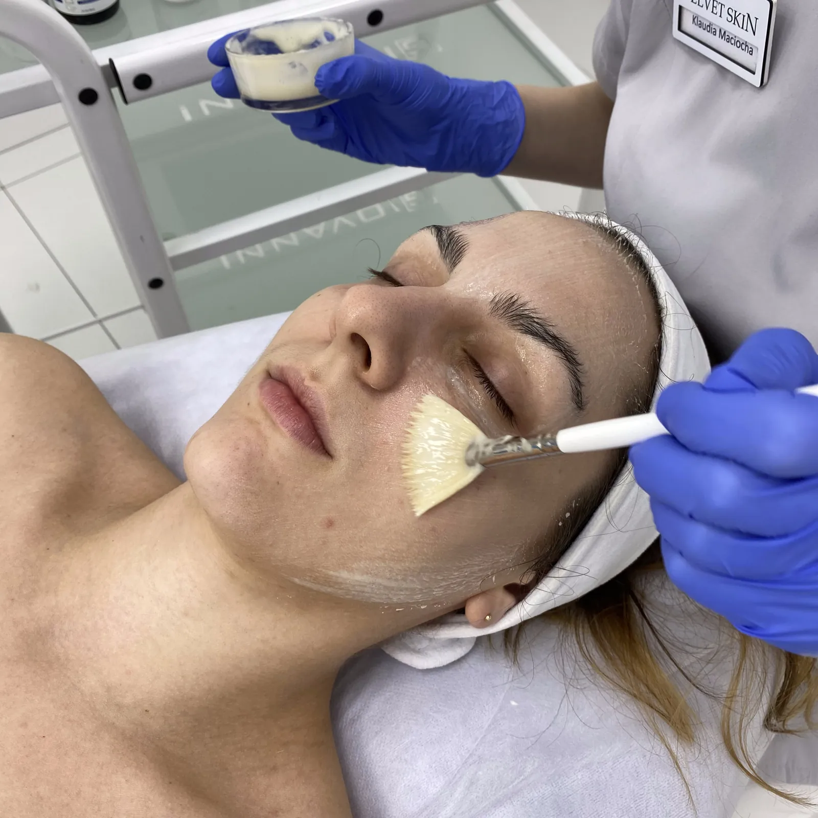 Azelaic Peel DermaQuest™ — peeling z kwasem azelainowym — Velvet Skin Clinic Warszawa