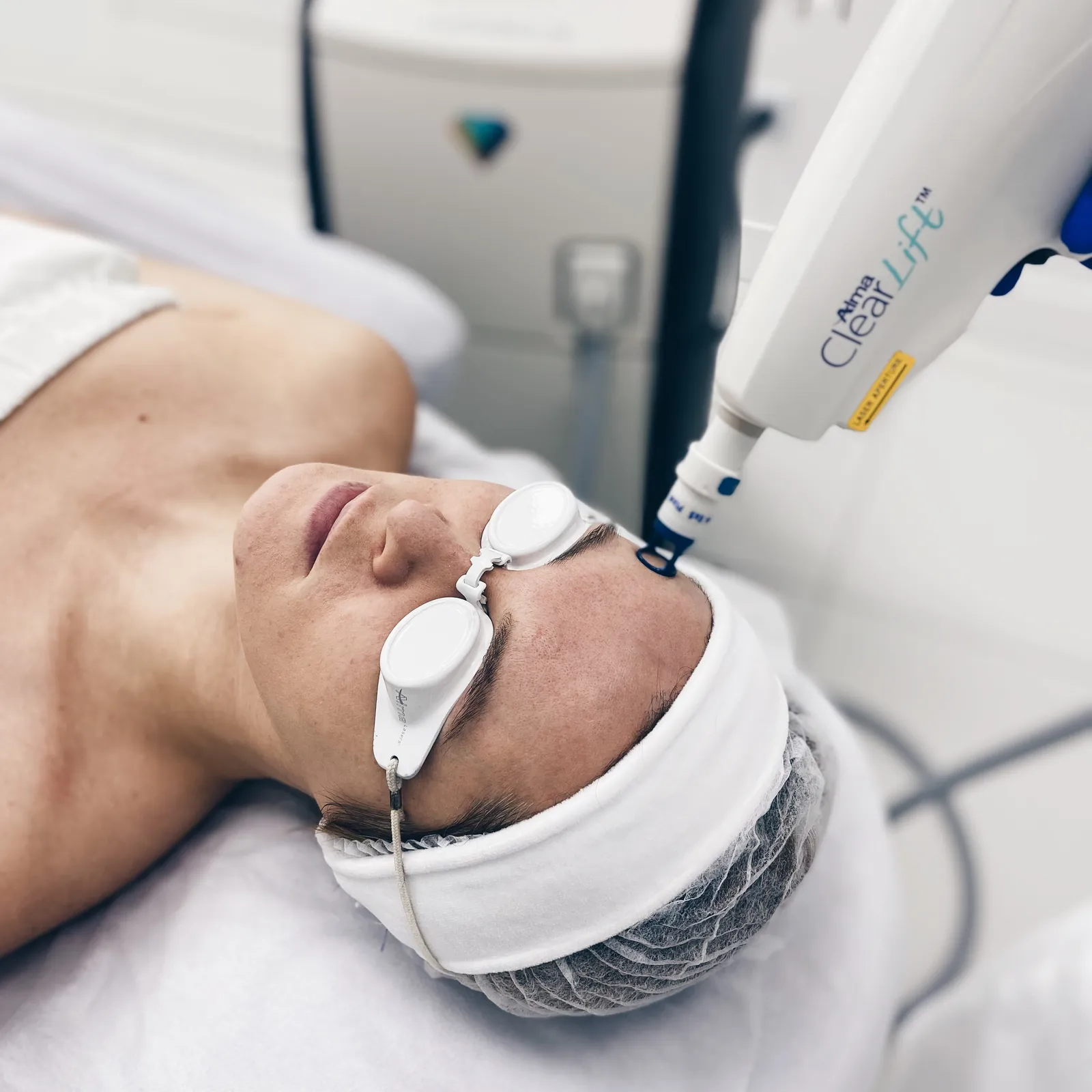 ClearLift™ Alma Harmony XL Pro — odmładzanie bez przestoju — Velvet Skin Clinic Warszawa