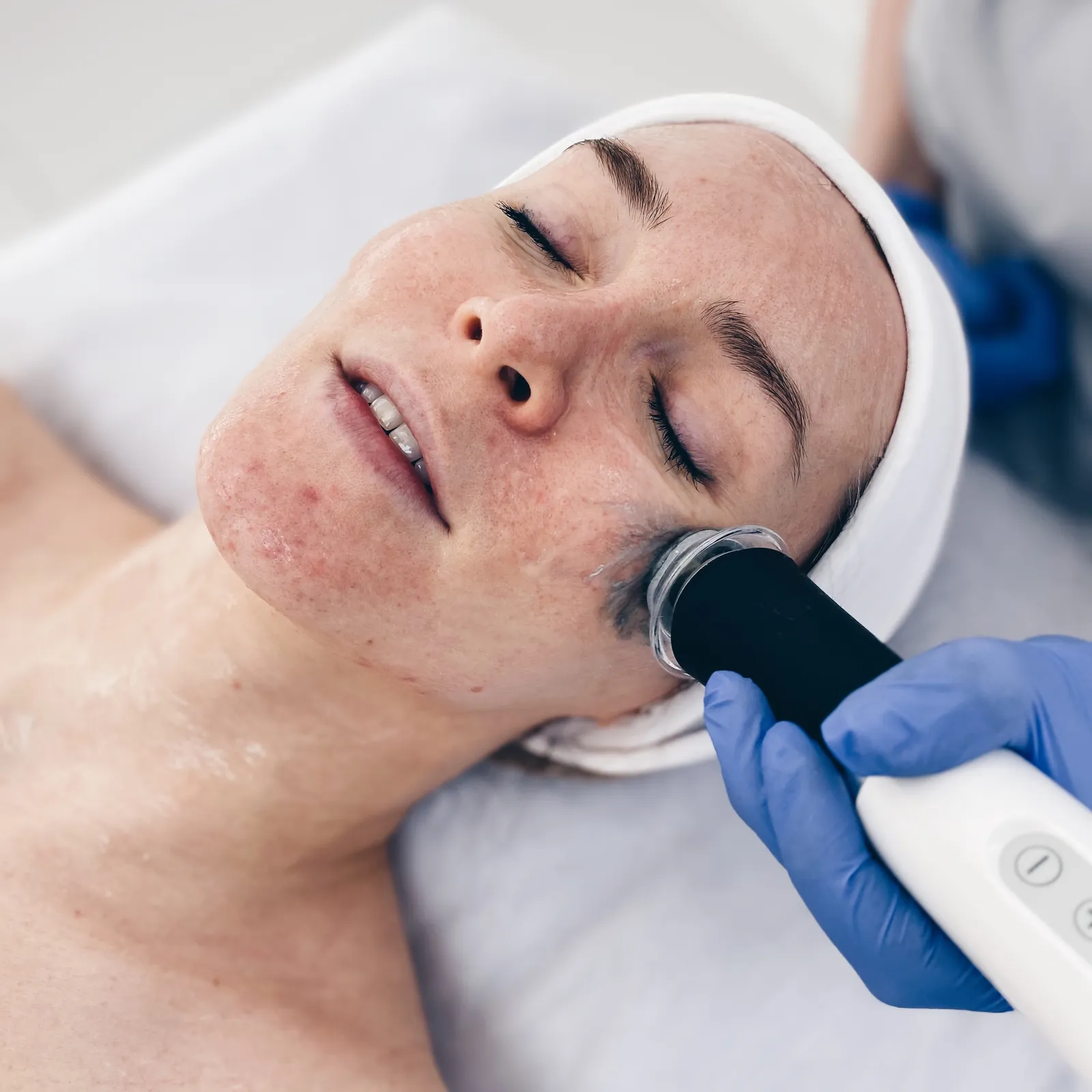 Geneo™ — ekspresowe dotlenianie i rozświetlanie skóry — Velvet Skin Clinic Warszawa