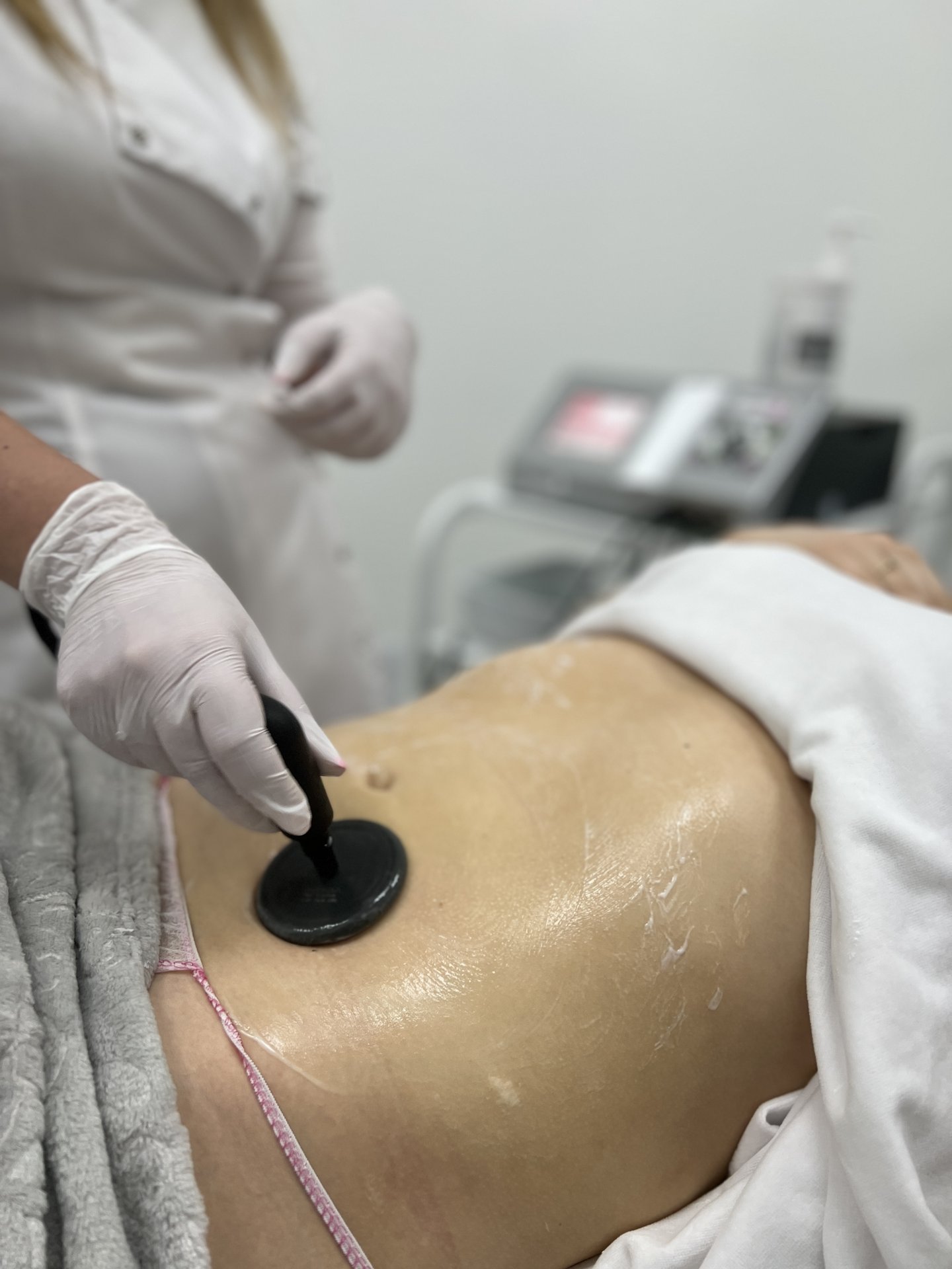 indiba — brzuch — modelowanie — hero — Velvet Skin Clinic