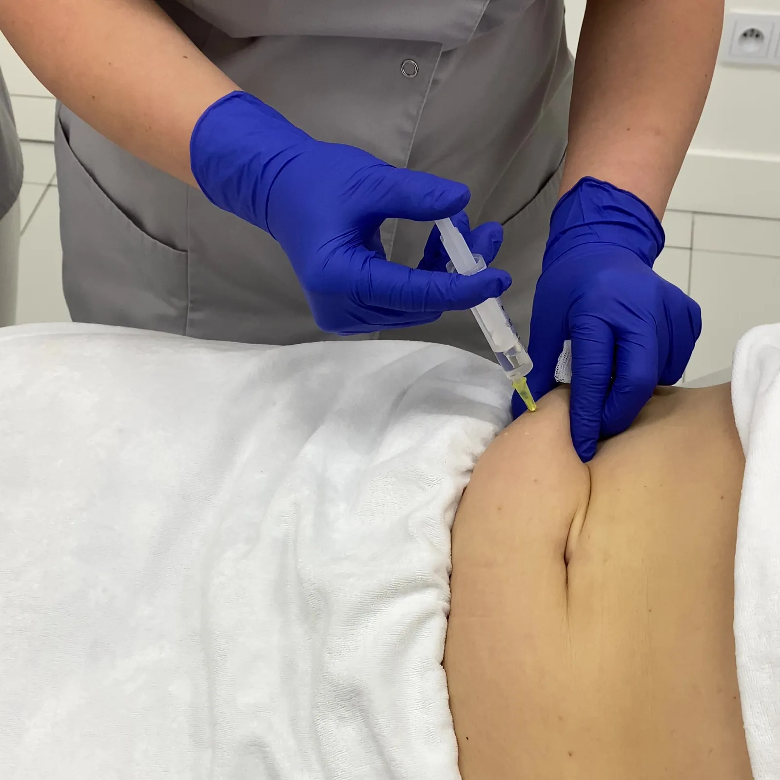 Lipoliza iniekcyjna — Velvet Skin Clinic Warszawa