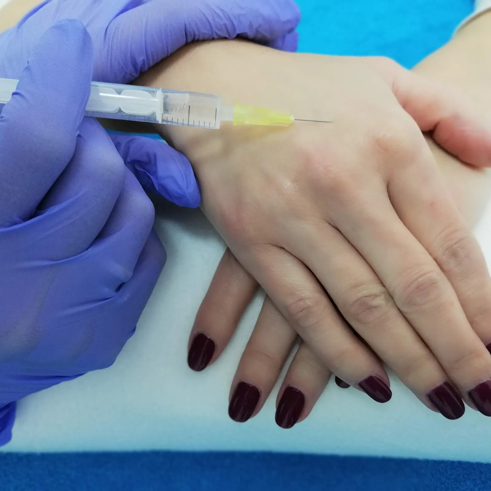 Mezoterapia igłowa ciała — Velvet Skin Clinic Warszawa