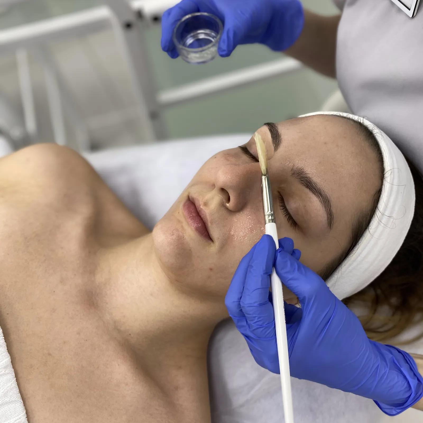 Medyczne peelingi chemiczne — kwasy na twarz w Warszawie — Velvet Skin Clinic Warszawa