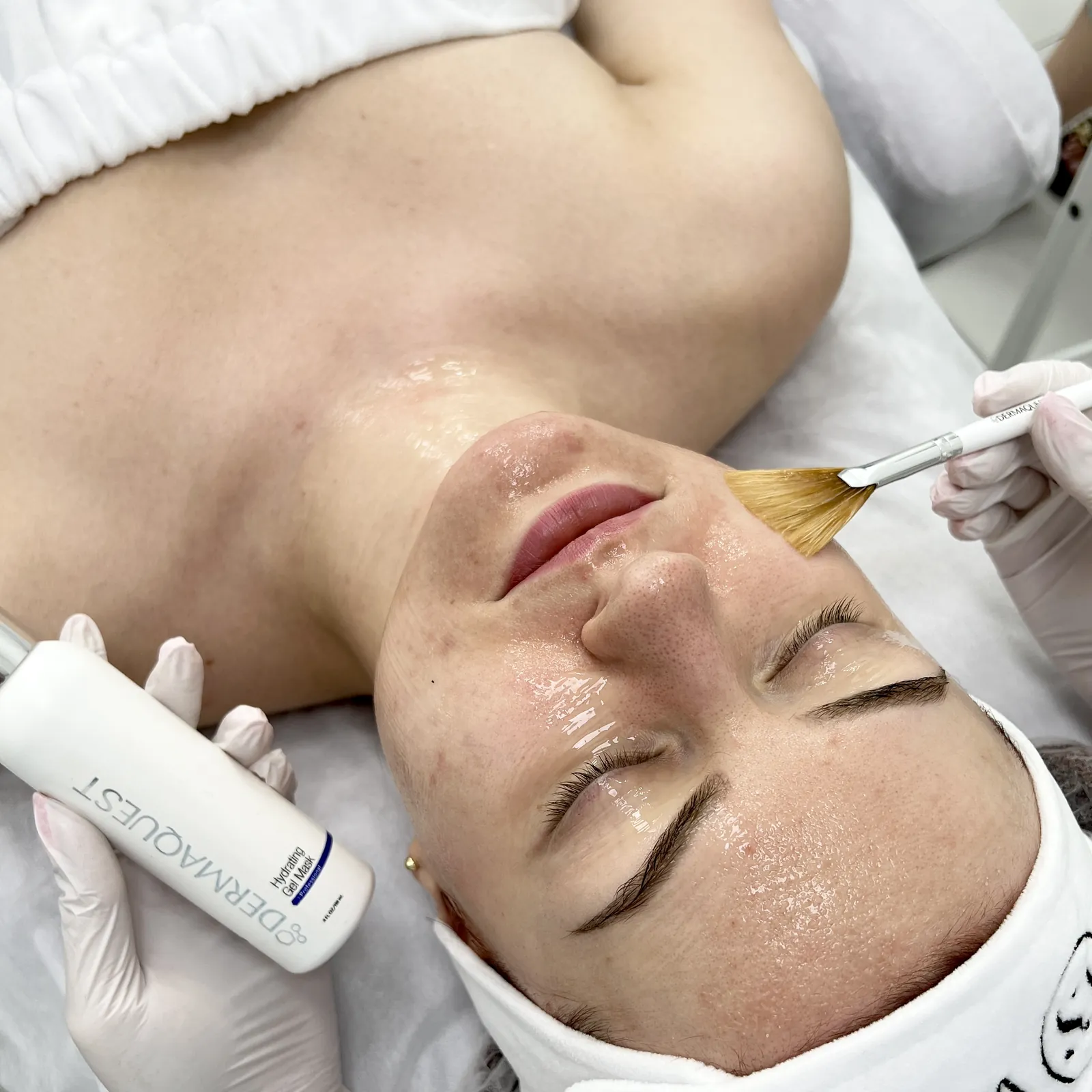 Peeling dyniowy DermaQuest™ — peeling na trądzik i łojotok z retinolem 4% — Velvet Skin Clinic Warszawa