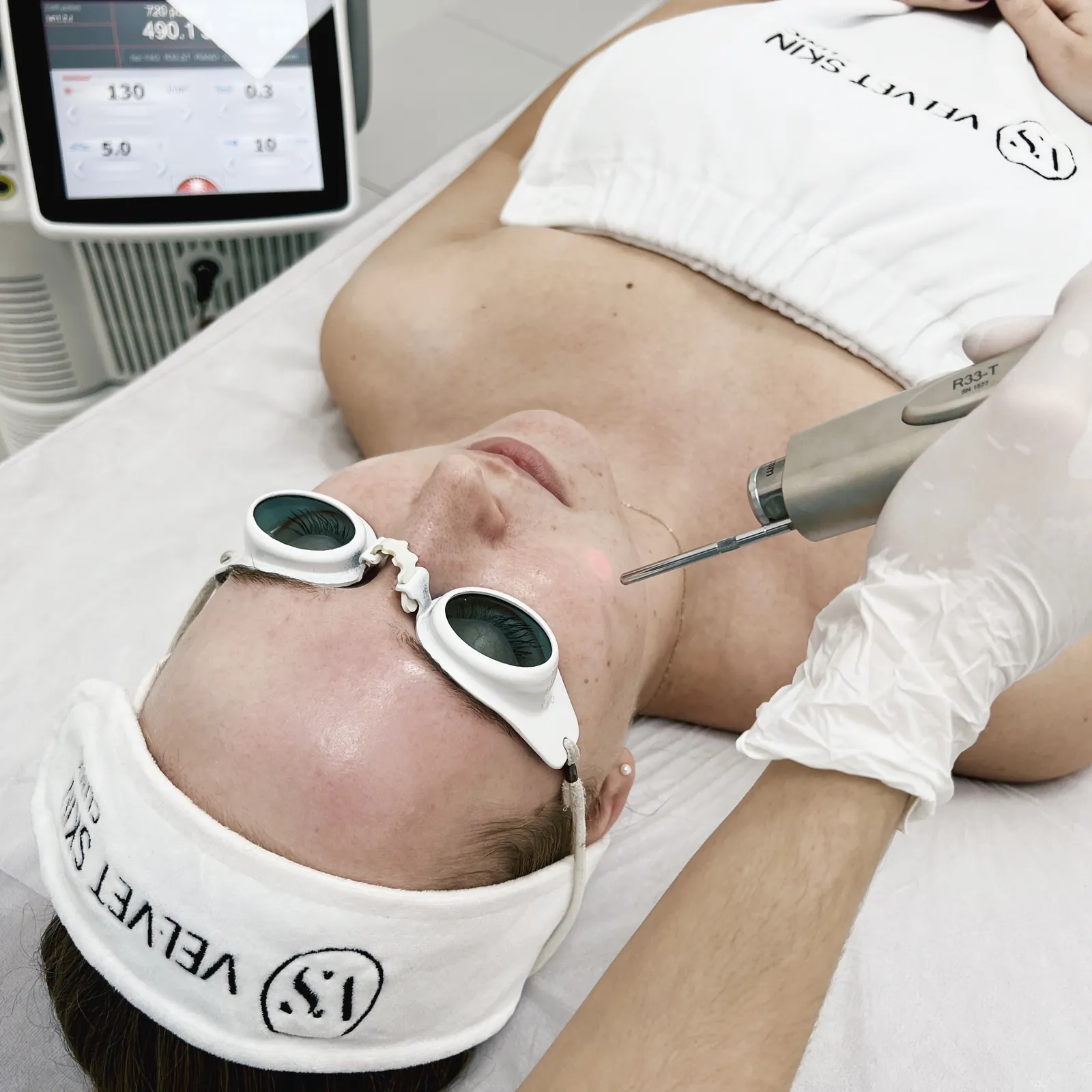 Termolifting laserowy PIANO™ — głębokie grzanie i lifting — Velvet Skin Clinic Warszawa