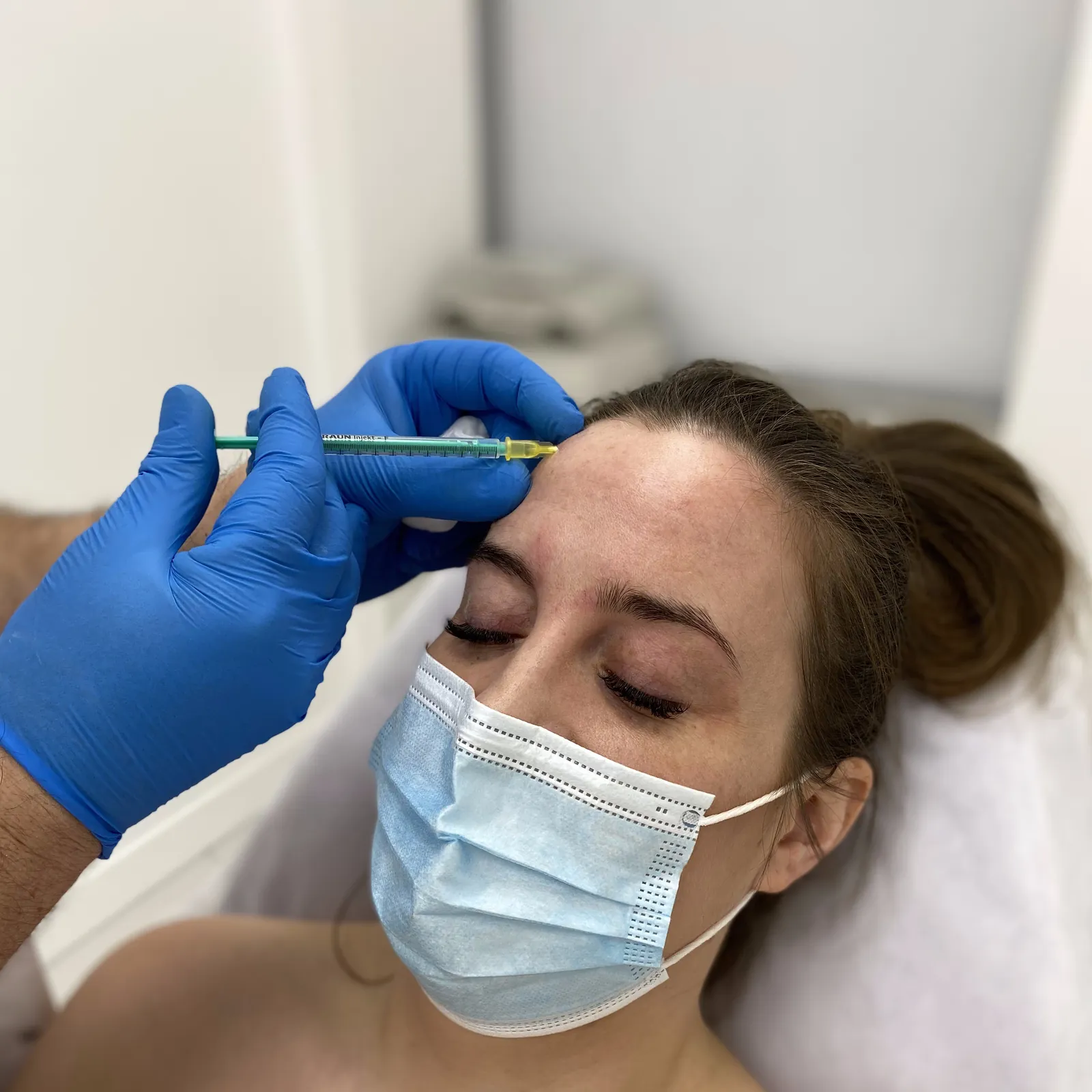 Toksyna botulinowa — Velvet Skin Clinic Warszawa