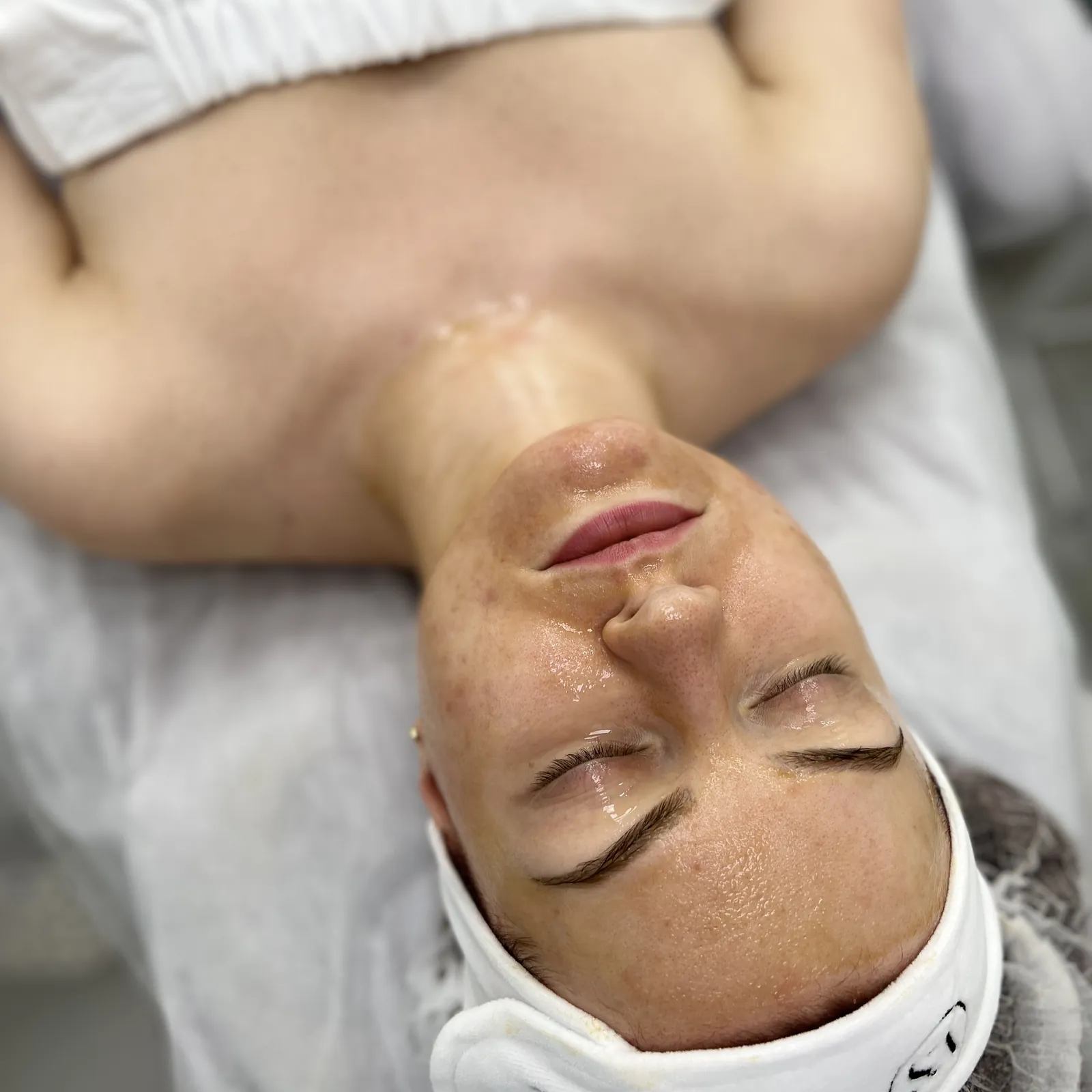 Terapeutyczny Zabieg Dyniowy DermaQuest™ — całoroczna kuracja dla skóry mieszanej i trądzikowej — Velvet Skin Clinic Warszawa