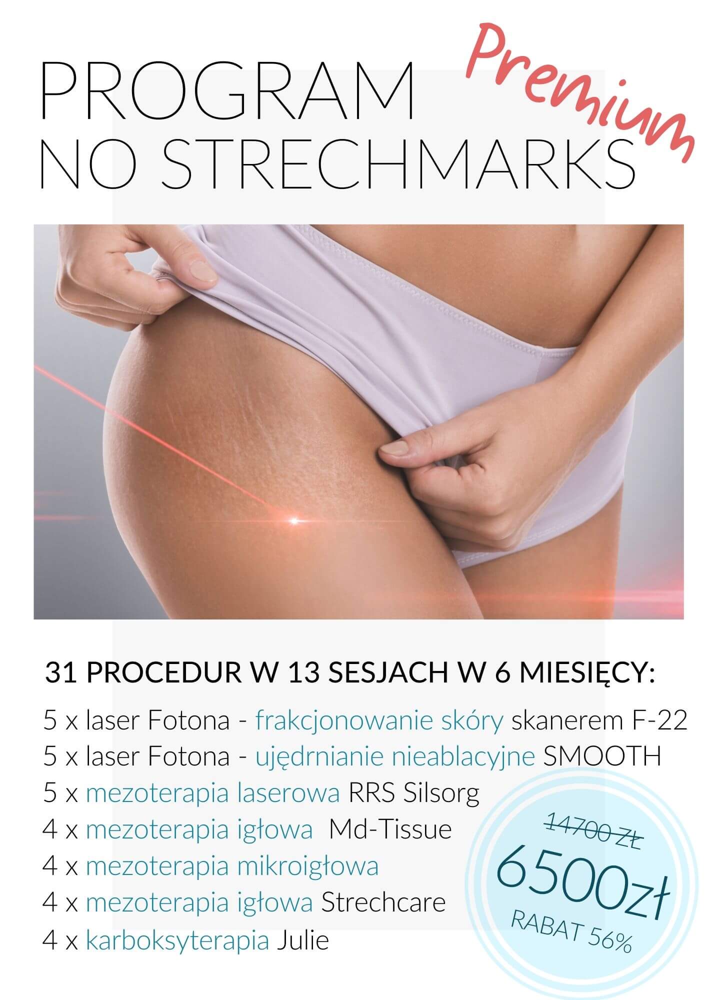 Program No Stretchmarks Premium — laserowa redukcja rozstępów