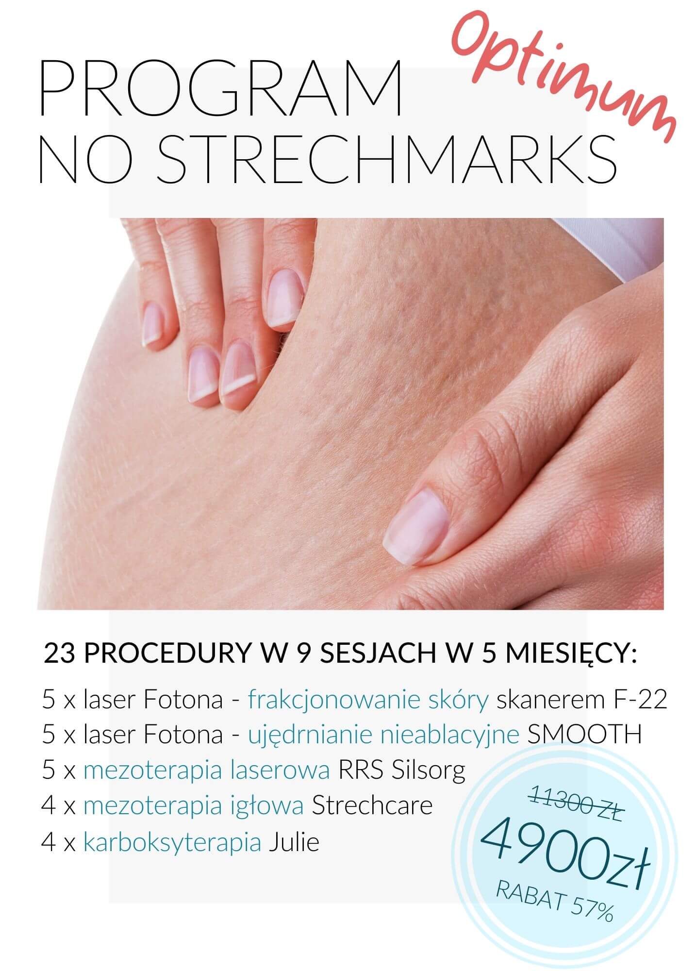 Program No Stretchmarks Optimum — laserowa redukcja rozstępów