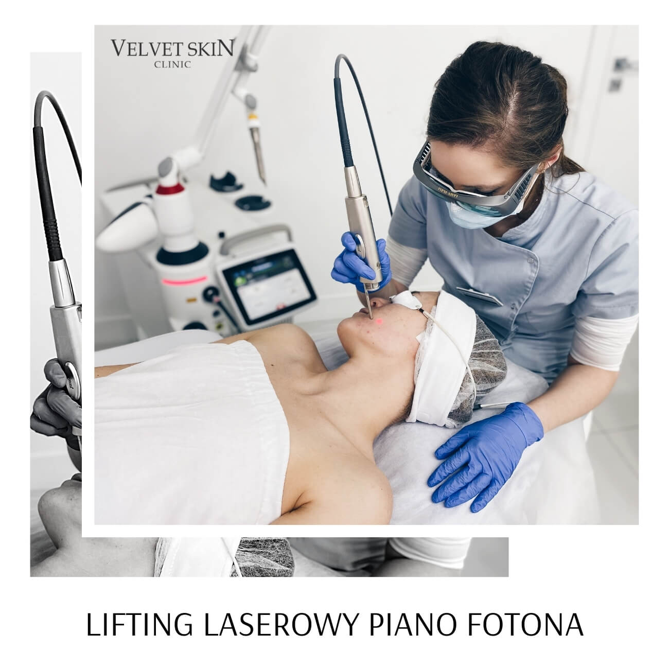 PIANO™ Laser Thermolifting — The PIANO laser lifting process