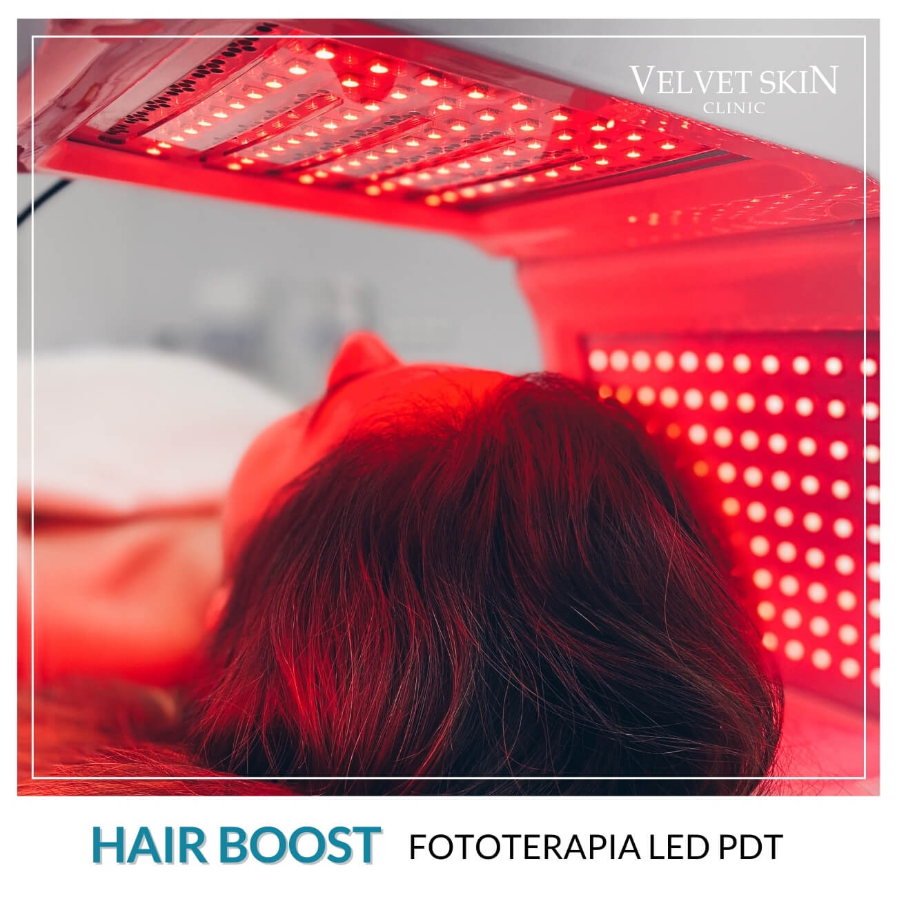 Program Hair Boost — Zabiegi w składzie programu Hair Boost