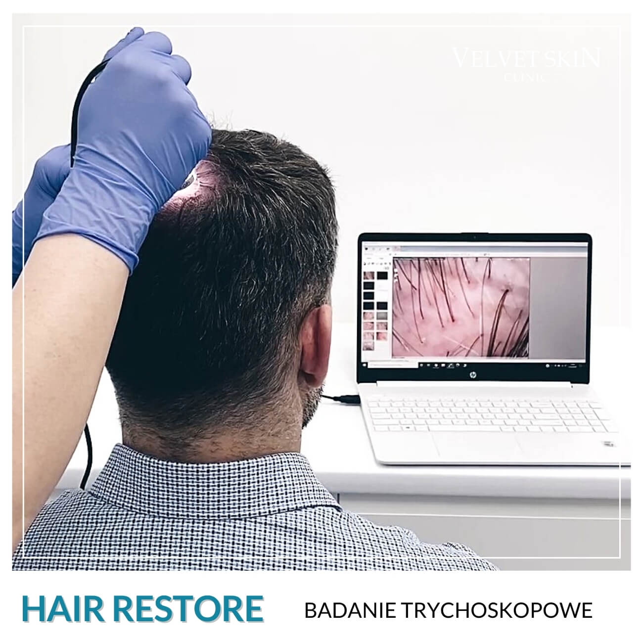 Program Hair Restore — Zabiegi w składzie programu Hair Restore