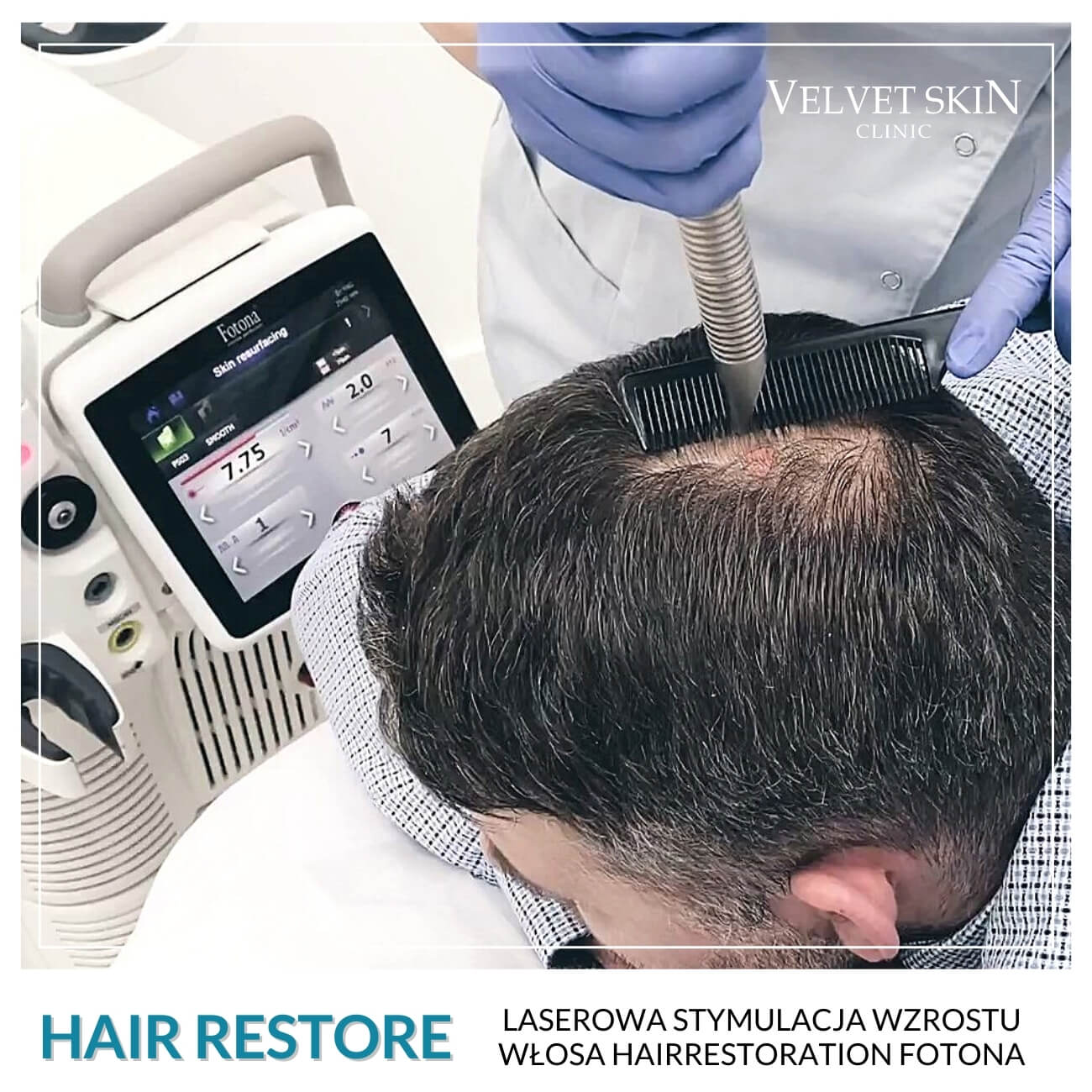 Program Hair Restore — Zabiegi w składzie programu Hair Restore