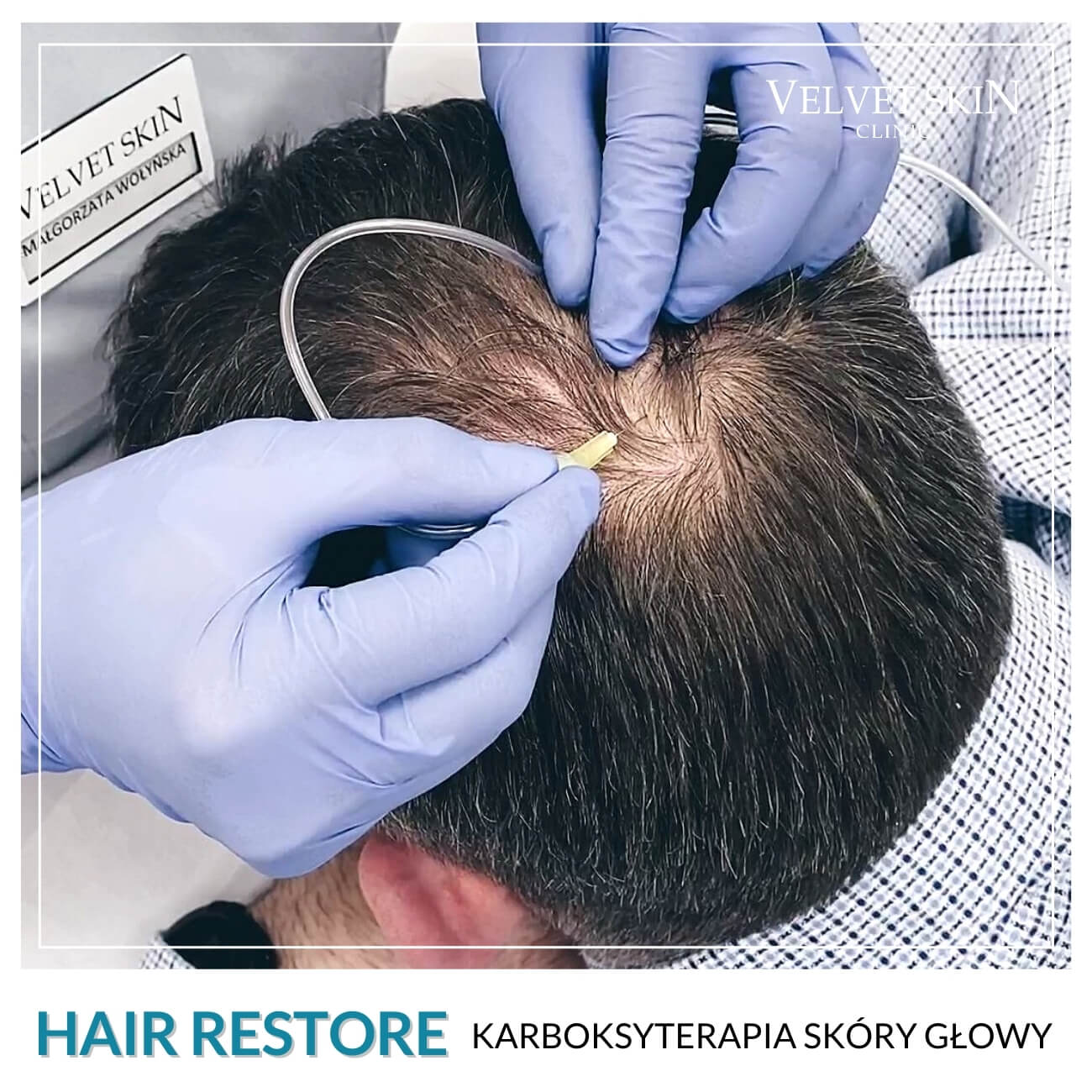 Program Hair Restore — Zabiegi w składzie programu Hair Restore