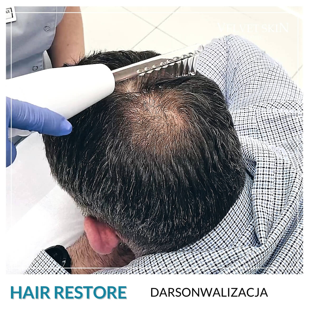 Program Hair Restore — Zabiegi w składzie programu Hair Restore