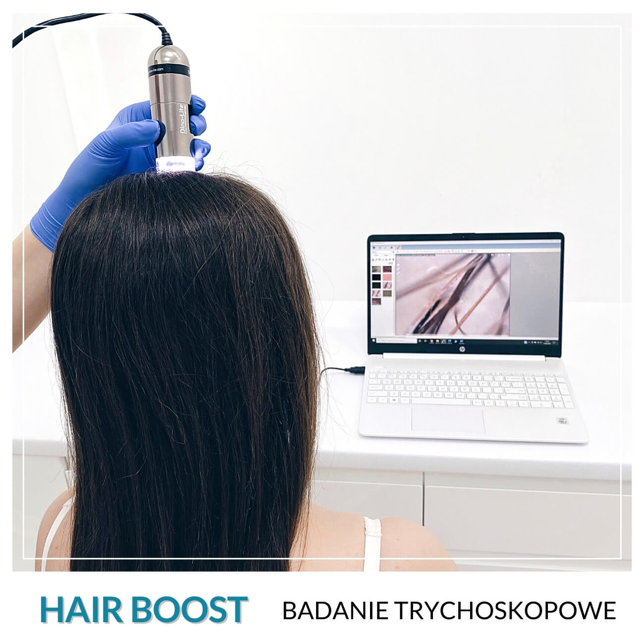 Program Hair Boost — Zabiegi w składzie programu Hair Boost