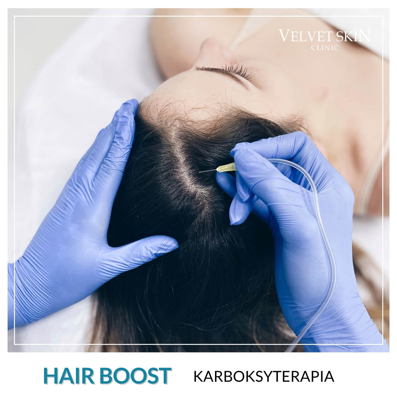 Program Hair Boost — Zabiegi w składzie programu Hair Boost