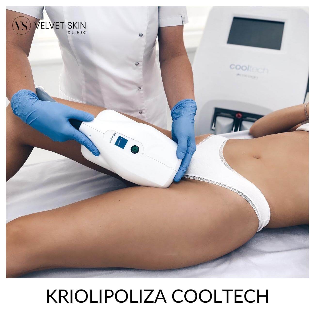 Kriolipoliza Cooltech — zabieg na wewnętrzną część uda, Velvet Skin Clinic