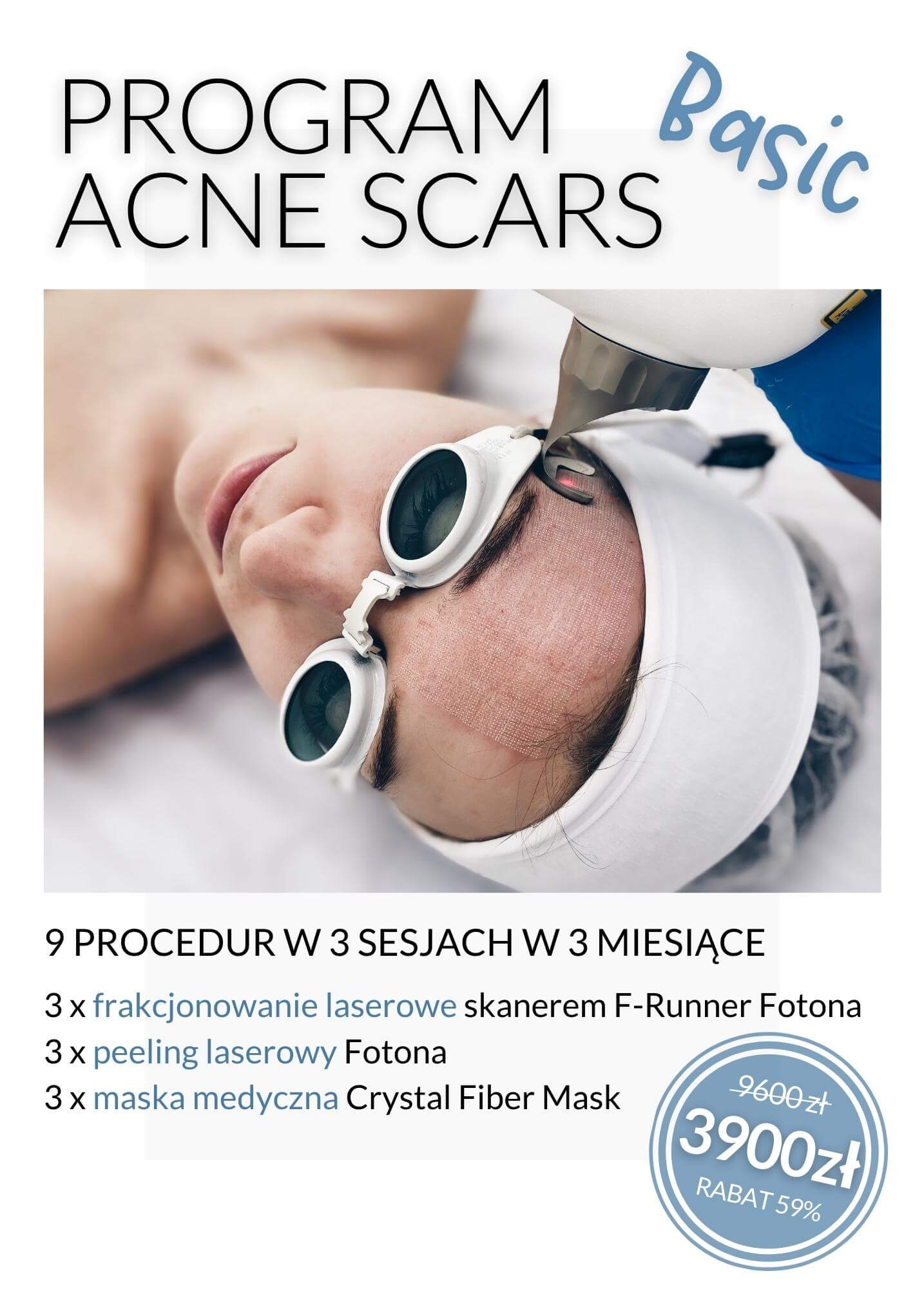 Program Acne Scars Basic — laserowa redukcja blizn potrądzikowych