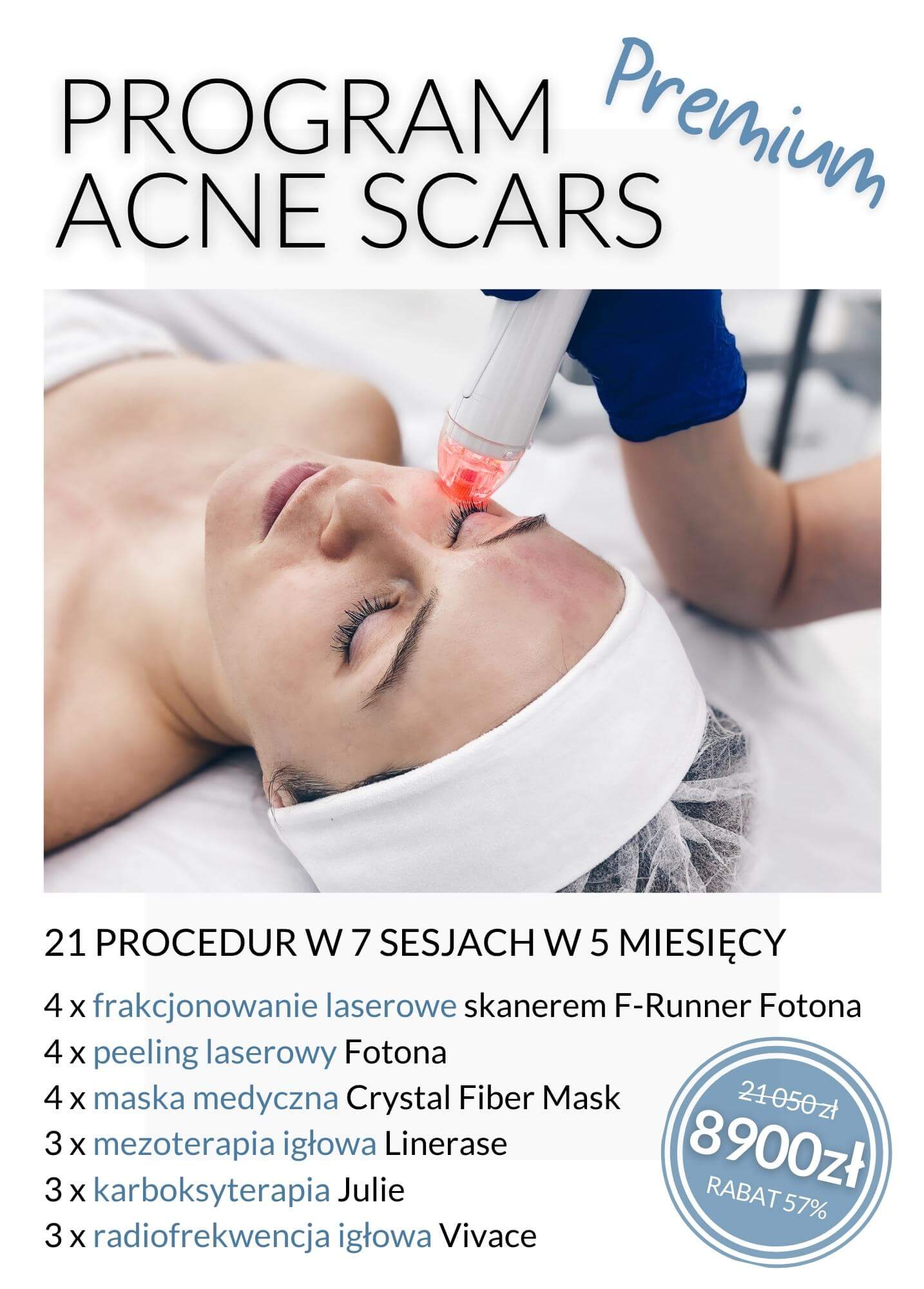 Program Acne Scars Premium — laserowa redukcja blizn potrądzikowych