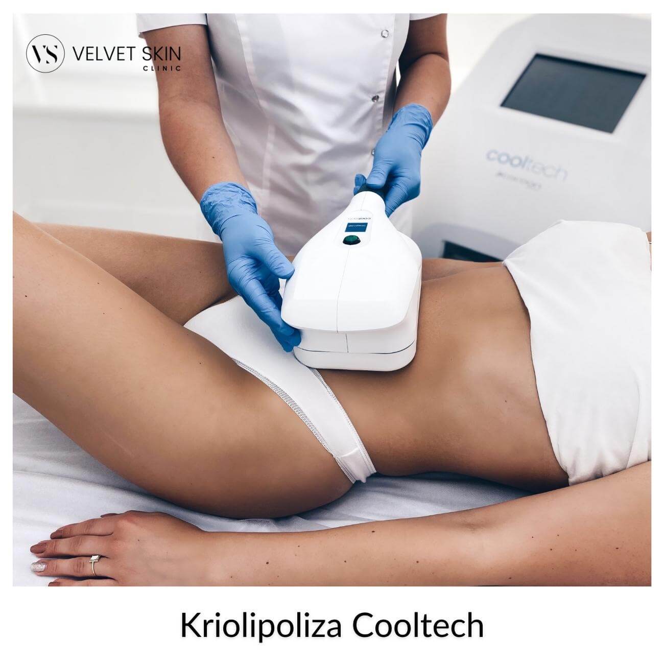 Kriolipoliza Cooltech — zabieg na brzuch wykonywany przez kosmetologa, Velvet Skin Clinic