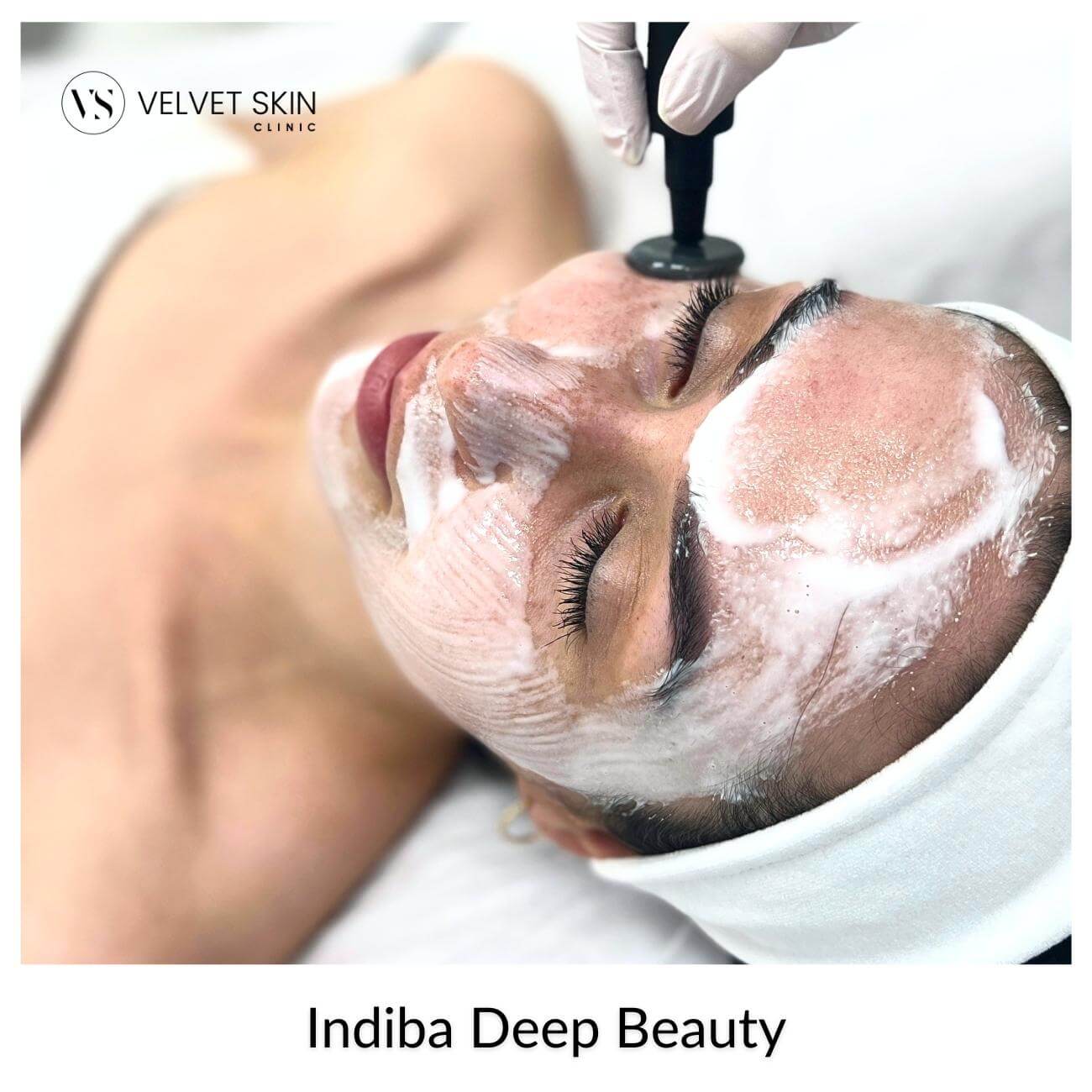 Indiba Deep Beauty — deep radiofrequency facial treatment at Velvet Skin Clinic