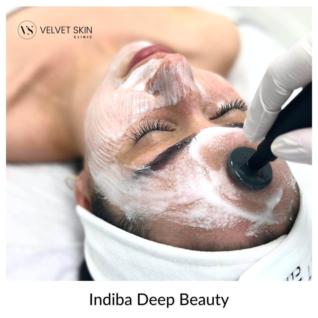 Indiba Deep Beauty — deep radiofrequency for the face, firming and skin lifting