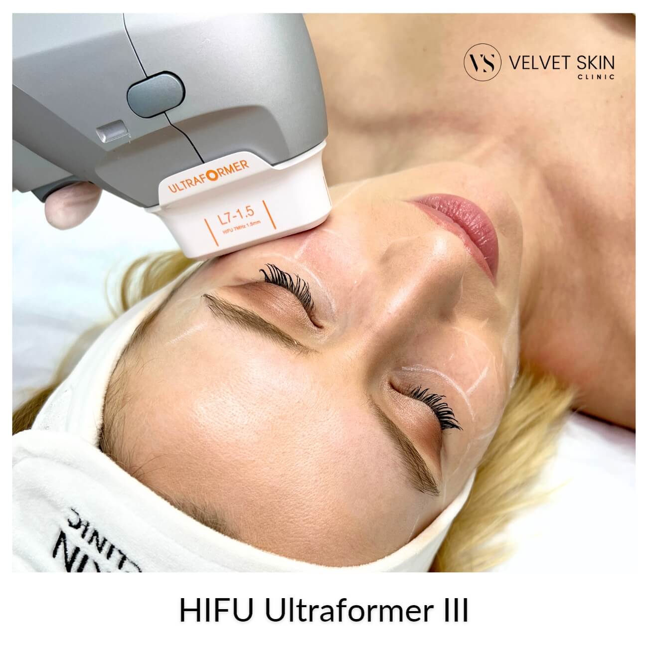 HIFU Ultraformer III Warszawa — Velvet Skin Clinic