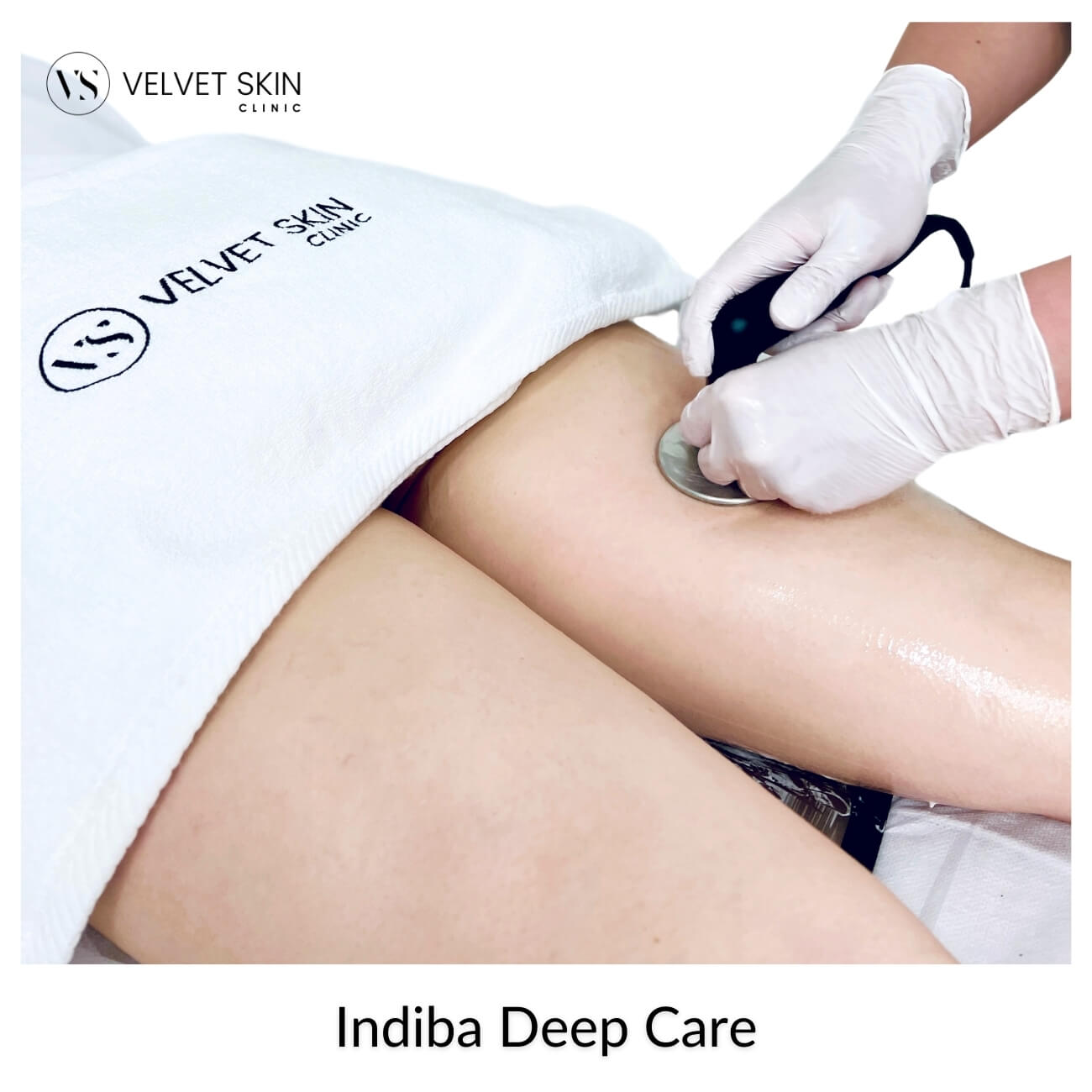 Indiba Deep Care — deep radiofrequency for the body, contouring and drainage