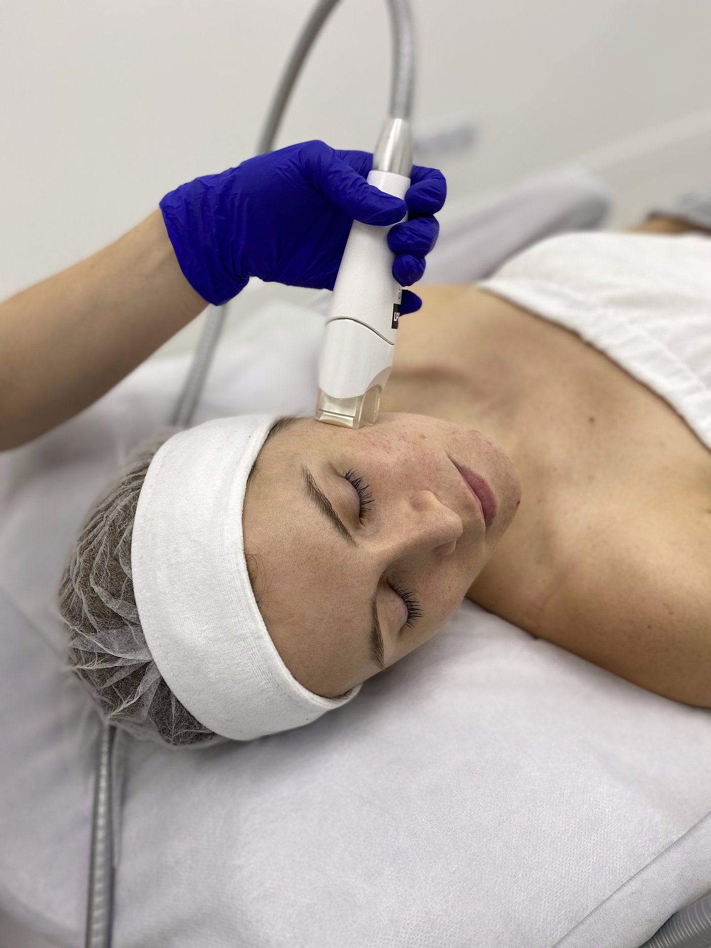 endermolift — okolica oczu — drenaz — hero — Velvet Skin Clinic