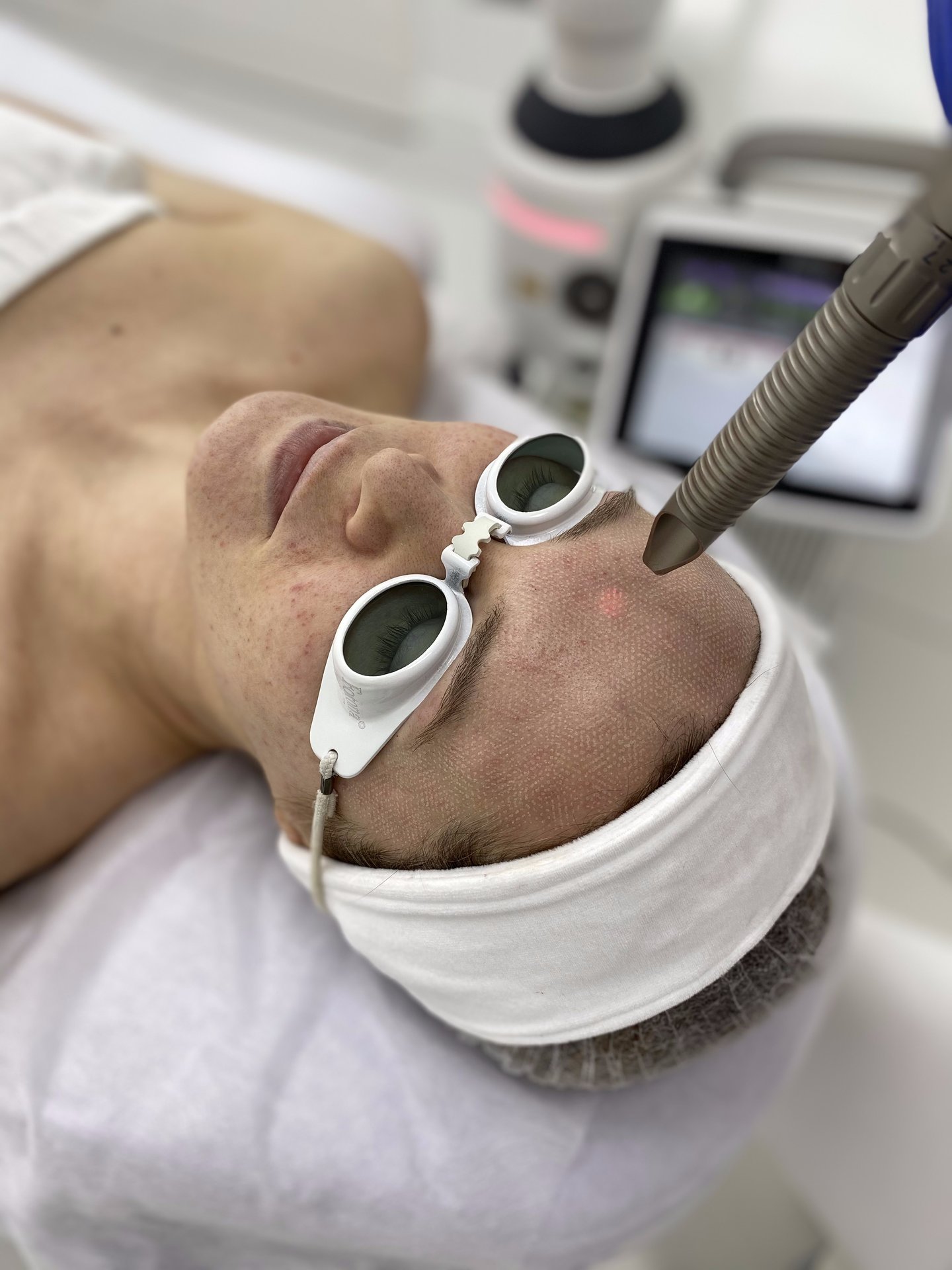 Fotona — frakcjonowanie laserowe twarzy, Velvet Skin Clinic