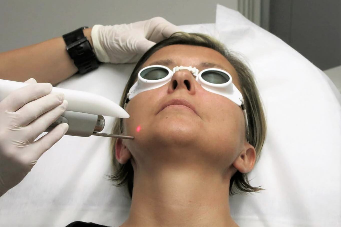FOTONA 4D™ laser facelift — Velvet Skin Clinic