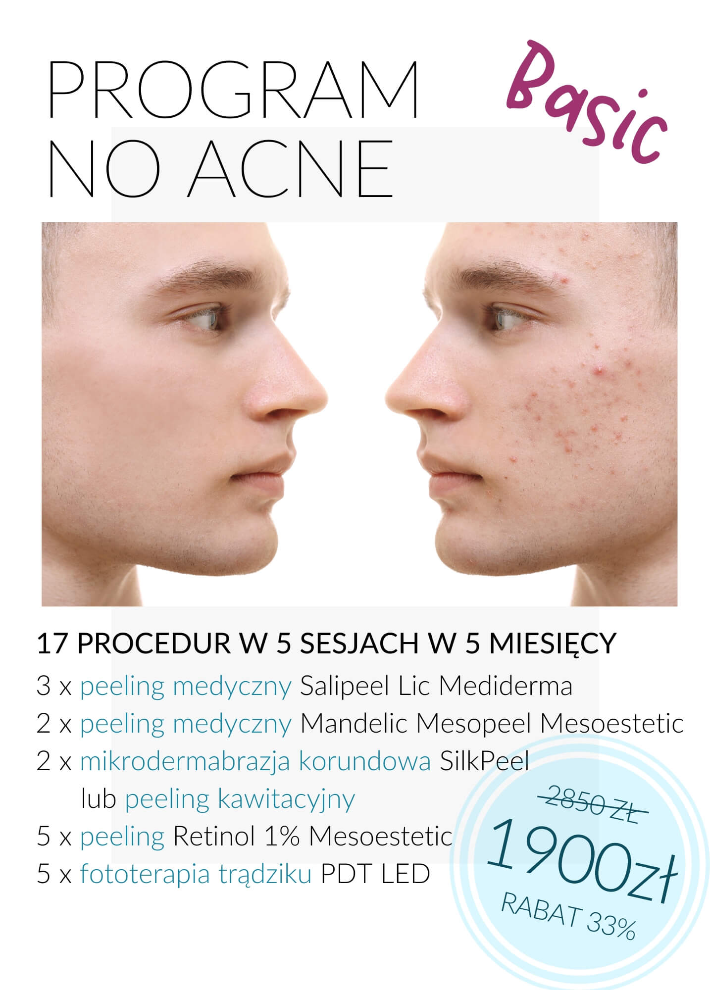 Programy antytrądzikowy No Acne — Velvet Skin Clinic