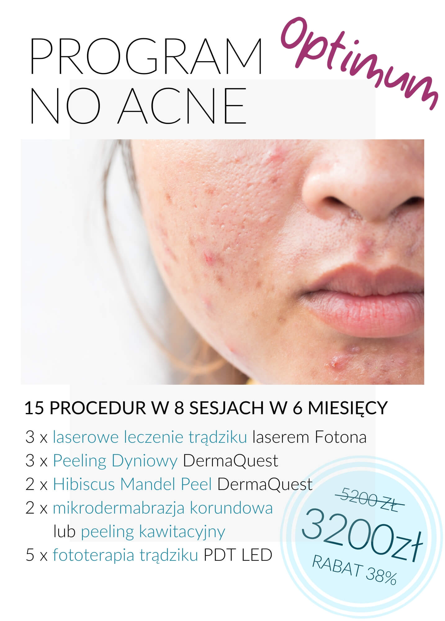 Programy antytrądzikowy No Acne — Velvet Skin Clinic