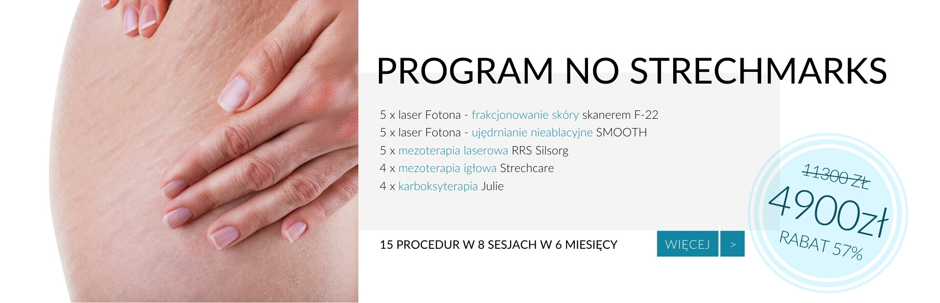 Program redukujący rozstępy No Stretchmarks — Velvet Skin Clinic