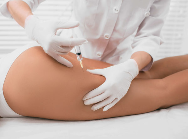 Program redukujący rozstępy No Stretchmarks — Velvet Skin Clinic