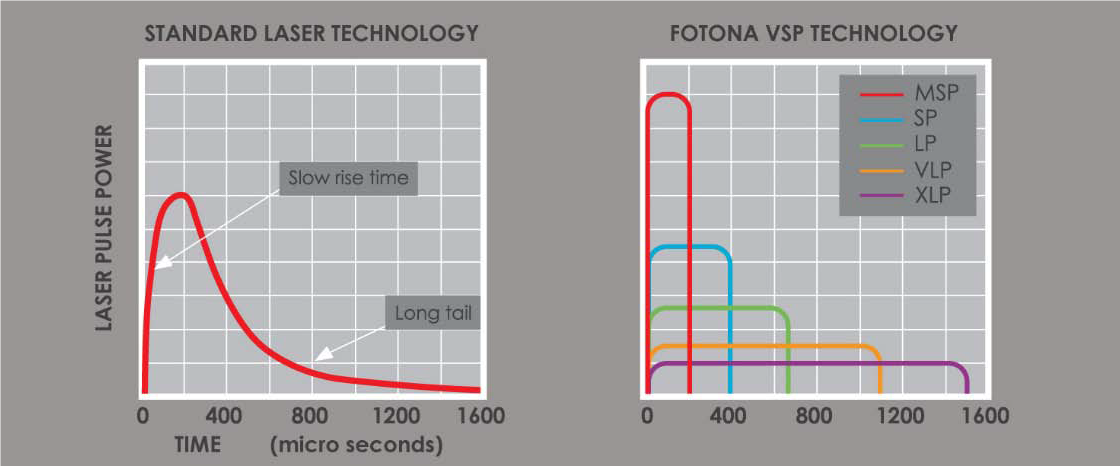 Zabiegi laserowe Fotona™ — Systemy bezpieczeństwa w laserach Fotona