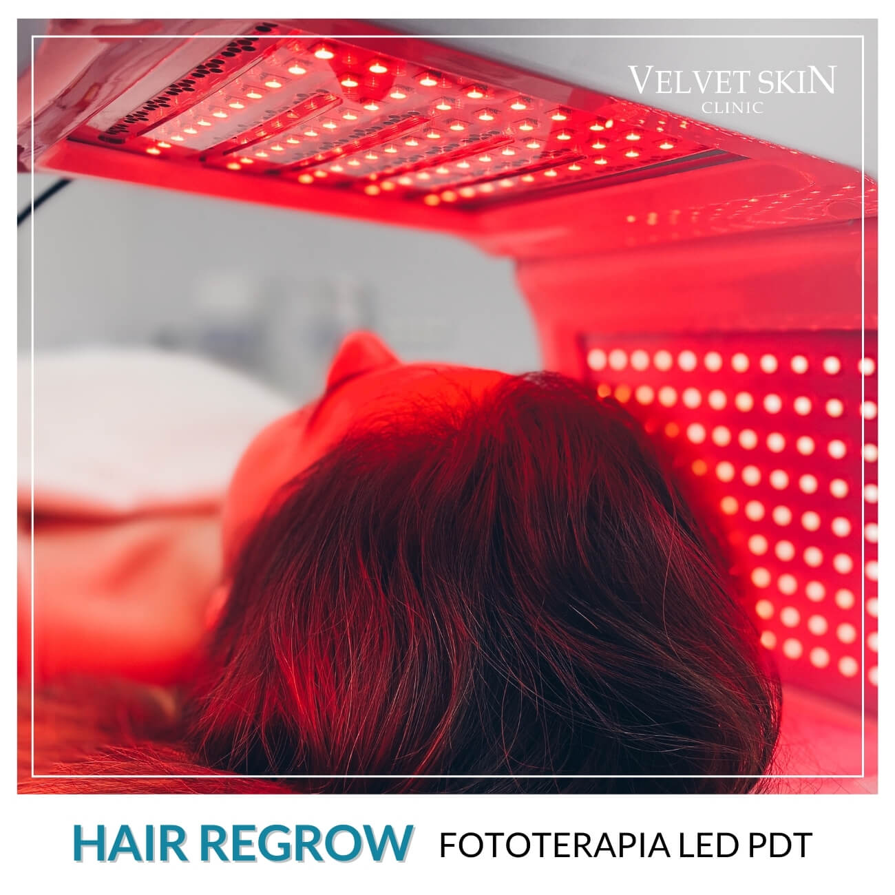 Program Hair Regrow — Zabiegi w składzie programu Hair Regrow