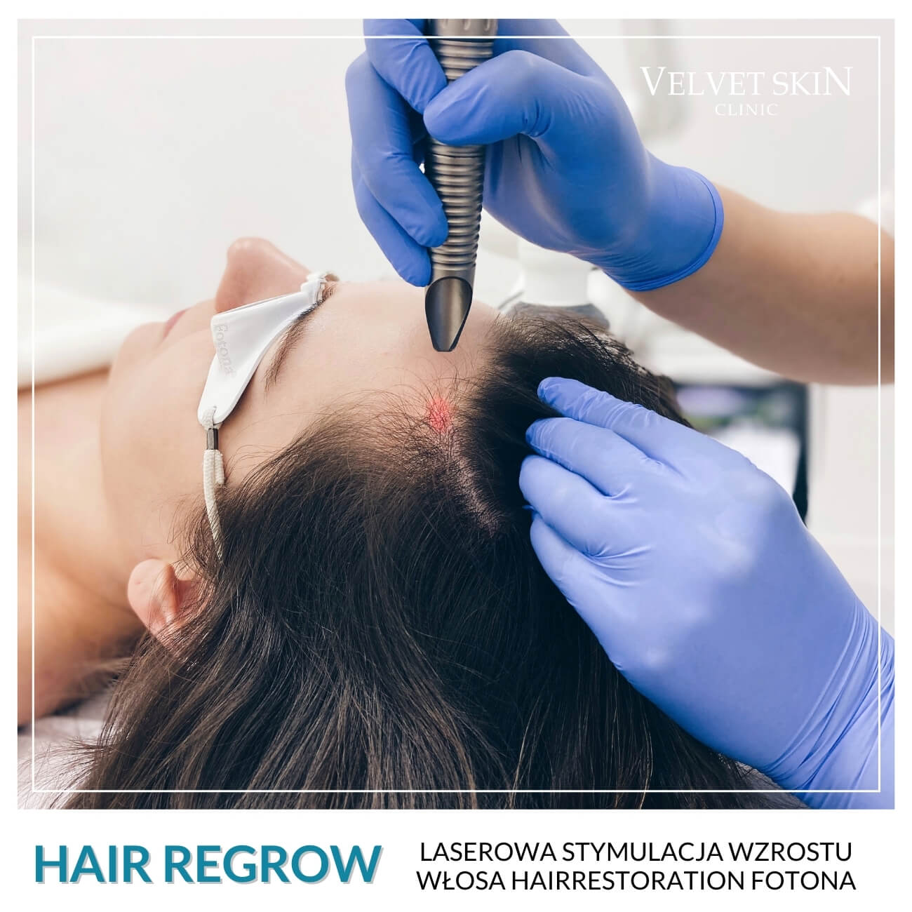 Program Hair Regrow — Zabiegi w składzie programu Hair Regrow