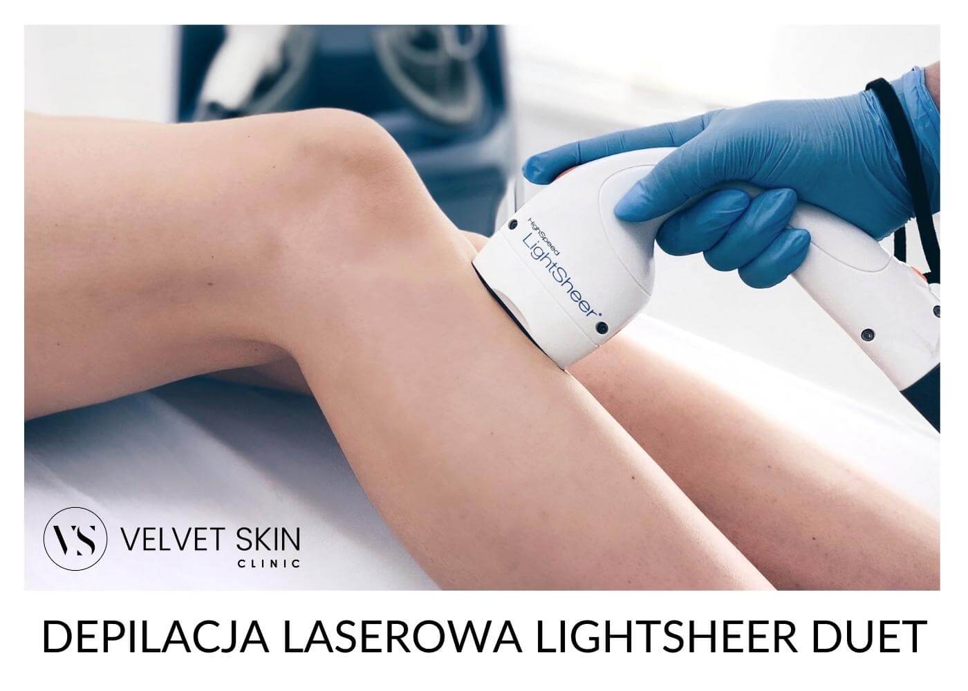 Depilacja laserowa nóg głowicą chłodzącą LightSheer Duet — Velvet Skin Clinic