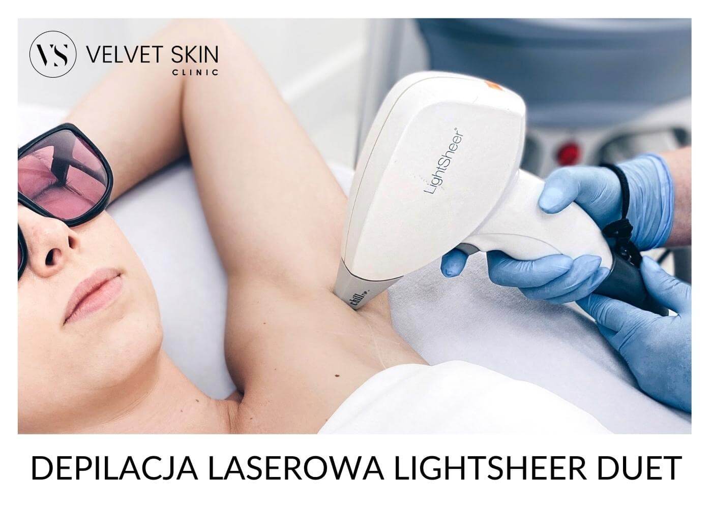 Depilacja laserowa pach laserem LightSheer Duet — Velvet Skin Clinic