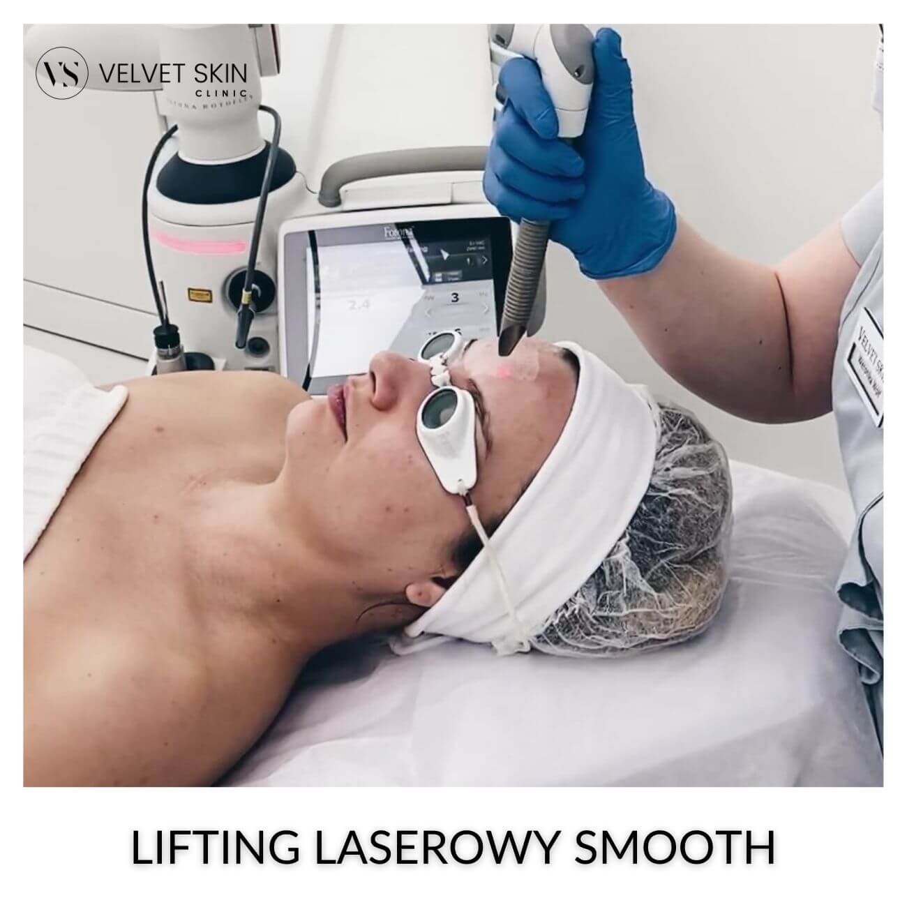 Laserowy termolifting SMOOTH w Velvet Skin Clinic