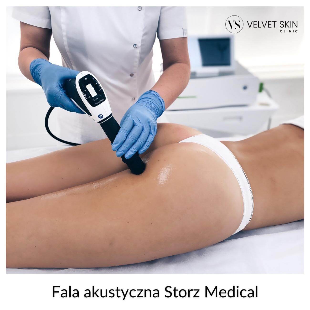 Fala akustyczna Storz Medical™ — Fala akustyczna Storz Medical™️ w modelowaniu sylwetki