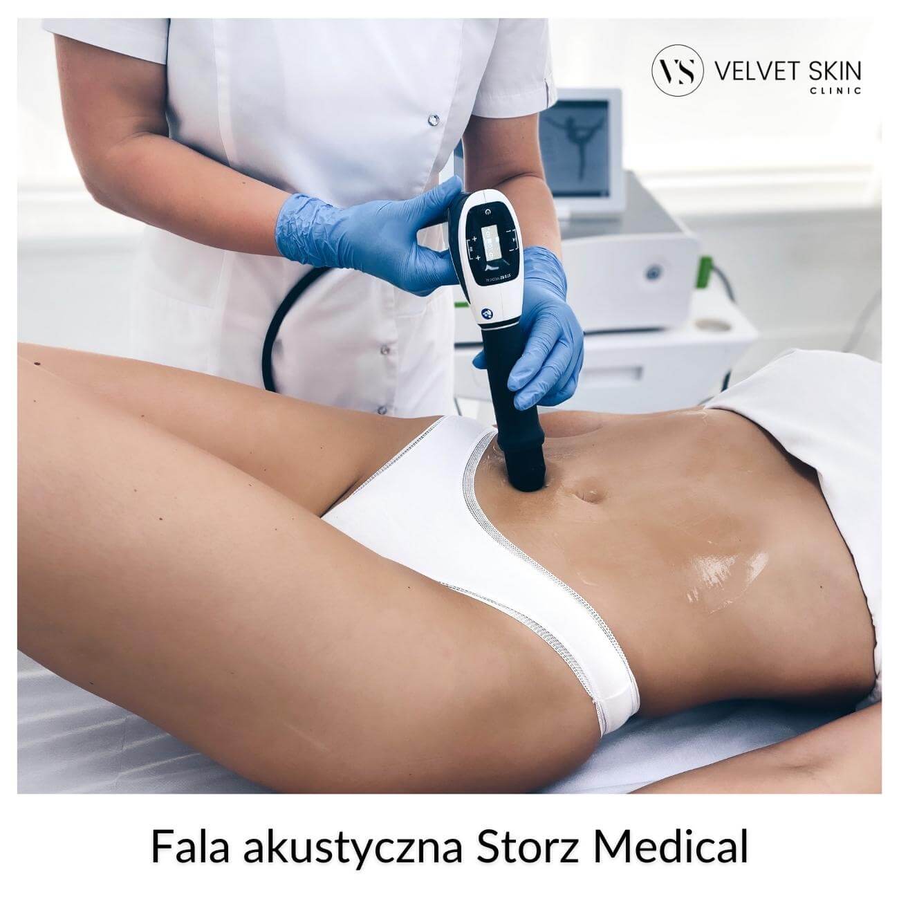 Fala akustyczna Storz Medical™ — Radialna fala akustyczna Storz Medical™️