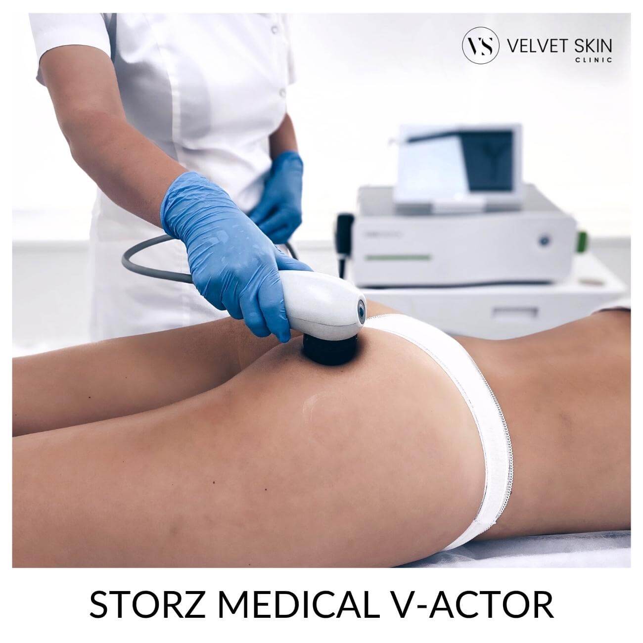Fala akustyczna Storz Medical™ — Głowice w urządzeniu Storz Medcial