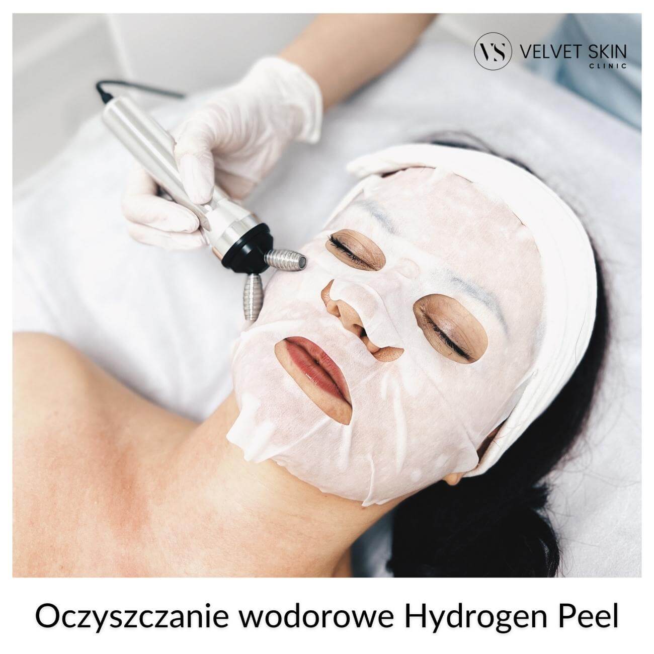 Hydrogen Peel™ — Hydrogen Peel 5D - rozszerzona wersja zabiegu