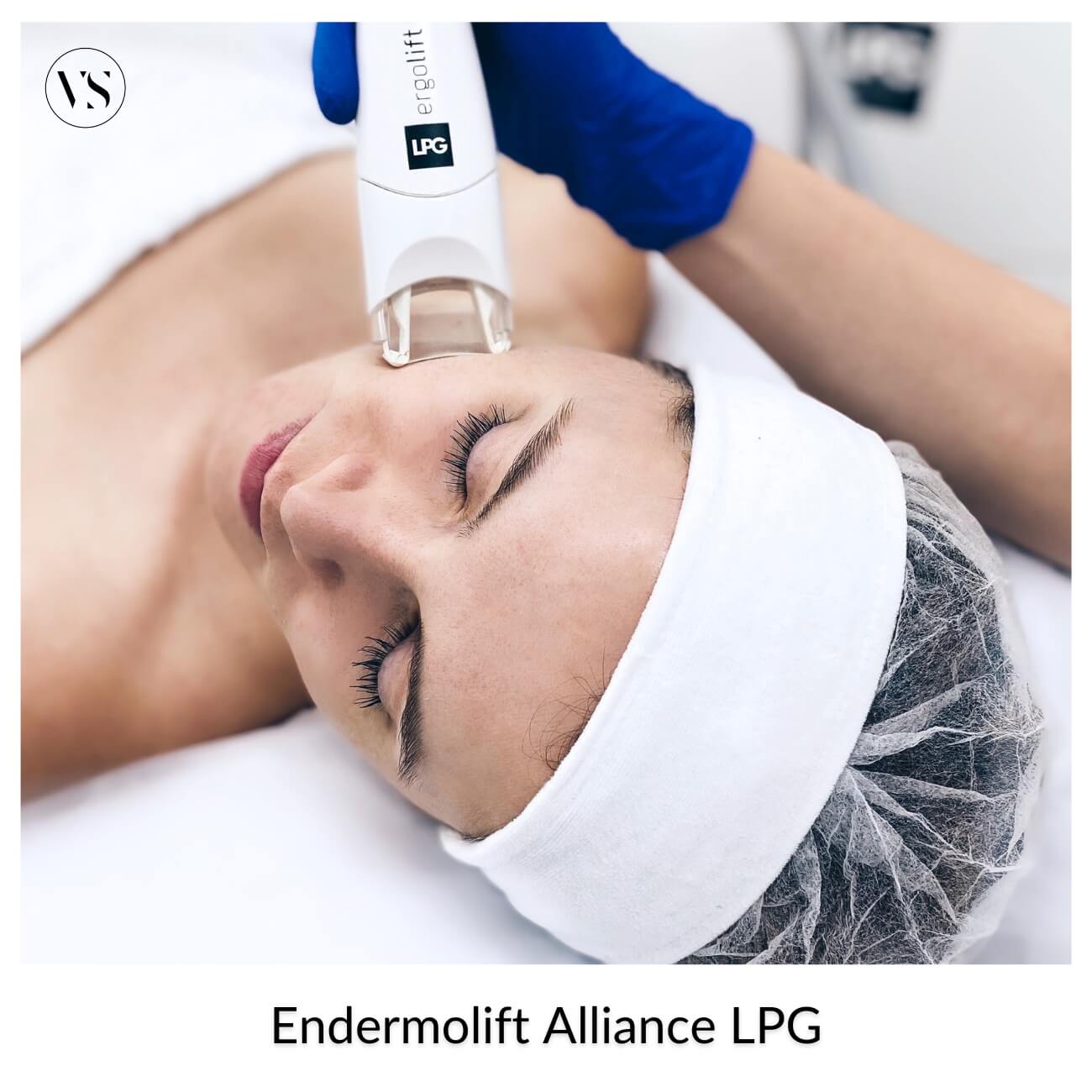 Endermolift Alliance LPG — masaż okolicy oczu
