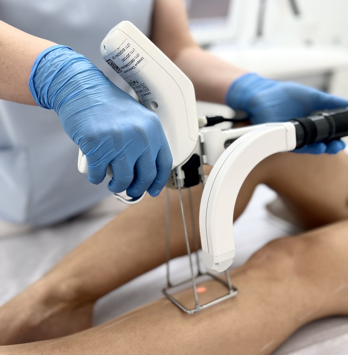 Depilacja laserowa nóg w Velvet Skin Clinic